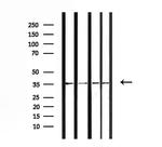 OR52E6/OR52E8 Antibody in Western Blot (WB)