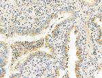 Opsin Blue Antibody in Immunohistochemistry (Paraffin) (IHC (P))