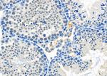 OR3A4 Antibody in Immunohistochemistry (Paraffin) (IHC (P))