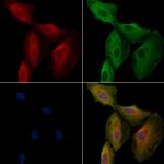 OR5T3 Antibody in Immunocytochemistry (ICC/IF)