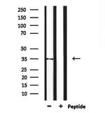 TAS2R31 Antibody in Western Blot (WB)