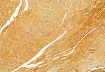 IFT88 Antibody in Immunohistochemistry (Paraffin) (IHC (P))