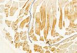 IFT88 Antibody in Immunohistochemistry (Paraffin) (IHC (P))