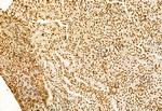 SHARPIN Antibody in Immunohistochemistry (Paraffin) (IHC (P))