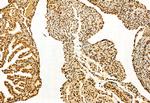 SHARPIN Antibody in Immunohistochemistry (Paraffin) (IHC (P))