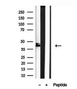 SHARPIN Antibody in Western Blot (WB)