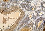 CNOT1 Antibody in Immunohistochemistry (Paraffin) (IHC (P))