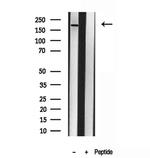 CNOT1 Antibody in Western Blot (WB)