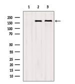 CNOT1 Antibody in Western Blot (WB)