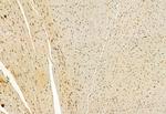 VPRBP Antibody in Immunohistochemistry (Paraffin) (IHC (P))