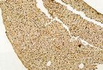 VPRBP Antibody in Immunohistochemistry (Paraffin) (IHC (P))