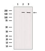 VPRBP Antibody in Western Blot (WB)