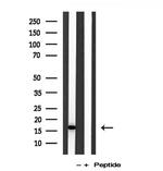 IFT20 Antibody in Western Blot (WB)