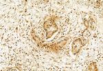 ADAM12 Antibody in Immunohistochemistry (Paraffin) (IHC (P))