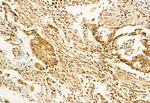 ADAM12 Antibody in Immunohistochemistry (Paraffin) (IHC (P))