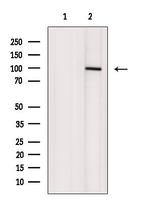 ADAM12 Antibody in Western Blot (WB)