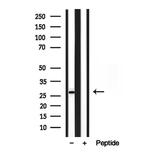 TPI1 Antibody in Western Blot (WB)