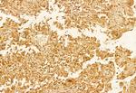 ECHS1 Antibody in Immunohistochemistry (Paraffin) (IHC (P))