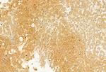 TCTN1 Antibody in Immunohistochemistry (Paraffin) (IHC (P))