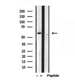 TCTN1 Antibody in Western Blot (WB)