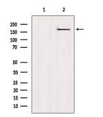 CAMSAP2 Antibody in Western Blot (WB)