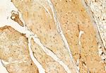 PRKCDBP Antibody in Immunohistochemistry (Paraffin) (IHC (P))