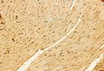 PRKCDBP Antibody in Immunohistochemistry (Paraffin) (IHC (P))