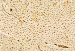 PRKCDBP Antibody in Immunohistochemistry (Paraffin) (IHC (P))