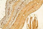 PRKCDBP Antibody in Immunohistochemistry (Paraffin) (IHC (P))