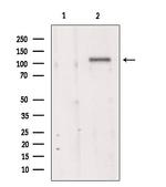 TMEM67 Antibody in Western Blot (WB)