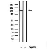 TMEM67 Antibody in Western Blot (WB)