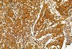 Pallidin Antibody in Immunohistochemistry (Paraffin) (IHC (P))