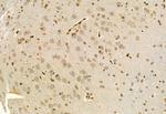 EXOC2 Antibody in Immunohistochemistry (Paraffin) (IHC (P))