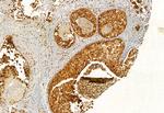 EXOC2 Antibody in Immunohistochemistry (Paraffin) (IHC (P))