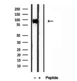 EXOC2 Antibody in Western Blot (WB)