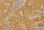 PYCR1 Antibody in Immunohistochemistry (Paraffin) (IHC (P))