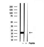 TAGLN2 Antibody in Western Blot (WB)