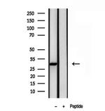 GALC Antibody in Western Blot (WB)