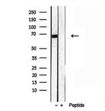 LMOD3 Antibody in Western Blot (WB)