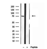 MPP5 Antibody in Western Blot (WB)