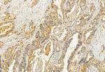 RAB27B Antibody in Immunohistochemistry (Paraffin) (IHC (P))