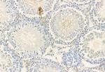 RAB27B Antibody in Immunohistochemistry (Paraffin) (IHC (P))