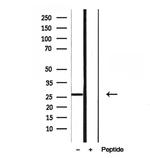 RAB27B Antibody in Western Blot (WB)