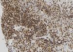 RBM15 Antibody in Immunohistochemistry (Paraffin) (IHC (P))