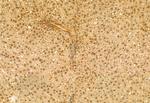 RBM15 Antibody in Immunohistochemistry (Paraffin) (IHC (P))