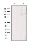 RBM15 Antibody in Western Blot (WB)