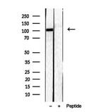 RBM15 Antibody in Western Blot (WB)