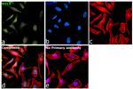 Phospho-MYL9 (Ser19) Antibody in Immunocytochemistry (ICC/IF)