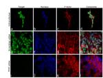 PHIP Antibody in Immunocytochemistry (ICC/IF)