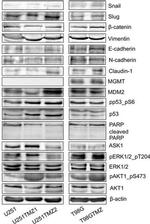 MDM2 Antibody in Western Blot (WB)